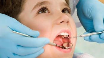 Hơn 90% người Việt gặp vấn đề răng miệng