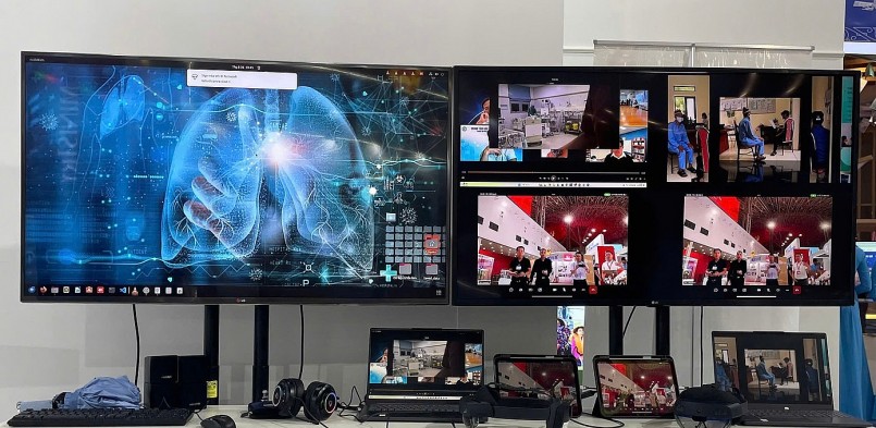 Phần mềm ứng dụng AI trong chẩn đoán ung thư phổi của Bệnh viện Bạch Mai. Phần mềm ứng dụng AI trong chẩn đoán ung thư phổi của Bệnh viện Bạch Mai.