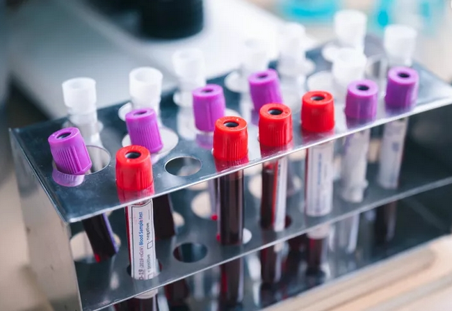 Bộ Y tế ước tính, nếu việc liên thông giúp giảm được chỉ 1% số xét nghiệm phải thực hiện lại, mỗi năm các bệnh viện sẽ giảm được khoảng 4,75 triệu lượt xét nghiệm. Bộ Y tế ước tính, nếu việc liên thông giúp giảm được chỉ 1% số xét nghiệm phải thực hiện lại, mỗi năm các bệnh viện sẽ giảm được khoảng 4,75 triệu lượt xét nghiệm.